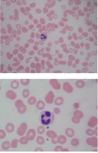 Lab Practice 2 Blood Smear Flashcards Quizlet