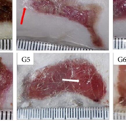 Macroscopic Aspects Of Partial Thickness Burn Wounds Experimentally