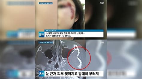 서울역 묻지마 폭행 용의자 자택서 검거구속영장 신청 방침