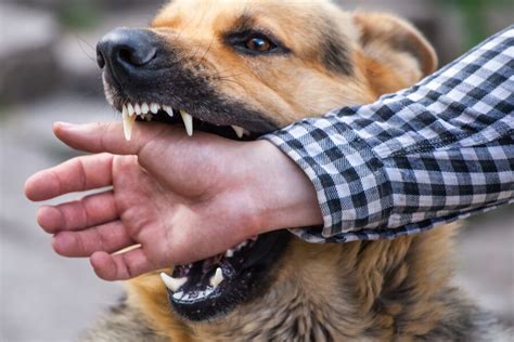 Medidas De Seguridad Para Prevenir Mordeduras De Perro Y Garantizar La