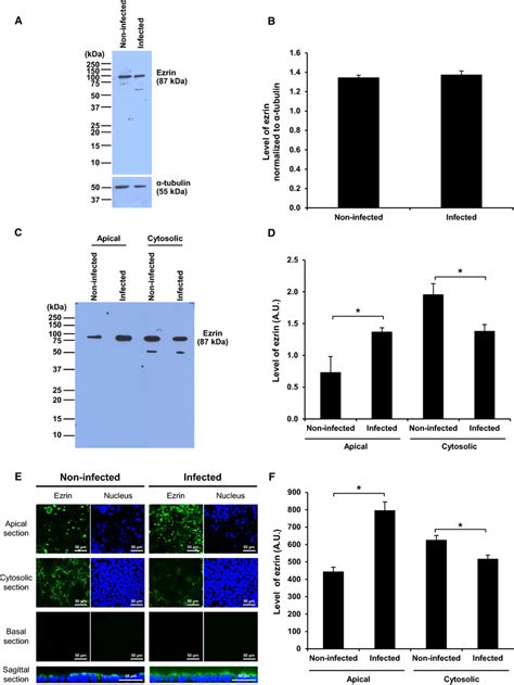 Expression And Localization Of Ezrin In Non Infected And Persistently Download Scientific