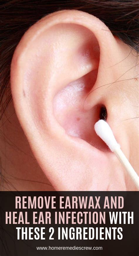 Remove Earwax And Heal Ear Infection With These 2 Ingredients Ear