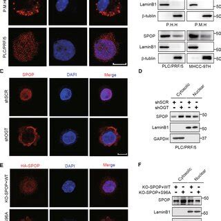 Spop O Glcnacylation Promotes Hcc Progression In Vitro And In Vivo A