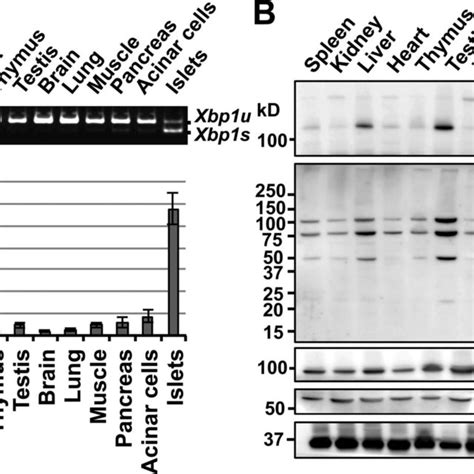 Physiological activation of the IRE1αXBP1 pathway in pancreatic