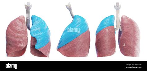 left lung illustration stock photo alamy