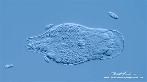 Protozoa Under Microscope Labeled