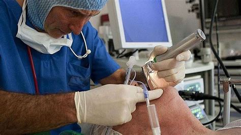 Short Periods Of Intubation During Surgery May Damage The Larynx Just