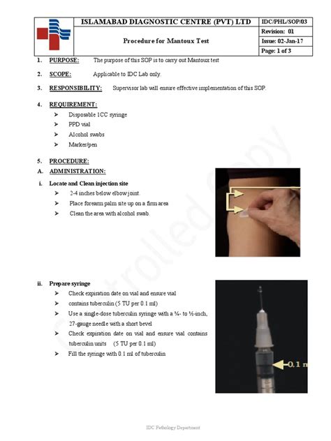 Procedure For Mantoux Test Pdf Clinical Medicine Medicine