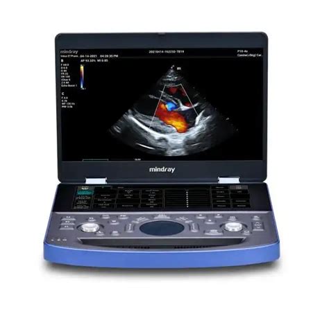 Mindray Vetus E7 MX7 Portable Ultrasound Imaging System For Veterinary