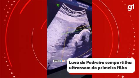 V Deo Luva De Pedreiro Compartilha Ultrassom Do Primeiro Filho Bahia