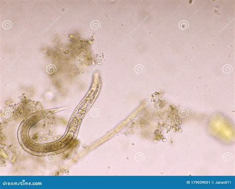 Strongyloides Stercoralis Or Threadworm In Human Stool Stock Image