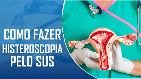 Histeroscopia Pelo Sus O Que Como Funciona E Participar Aqui