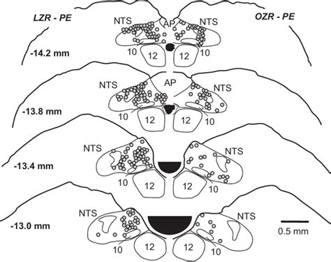 Representative Maps Of C Fos Expression In The Nucleus Tractus