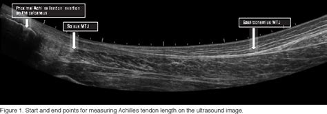 Figure 1 From Extended Field Of View Ultrasound Imaging To Evaluate