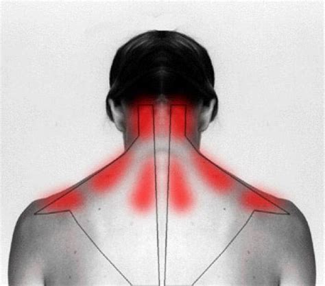 How To Easily Relieve Neck And Shoulder Pain Mental Scoop