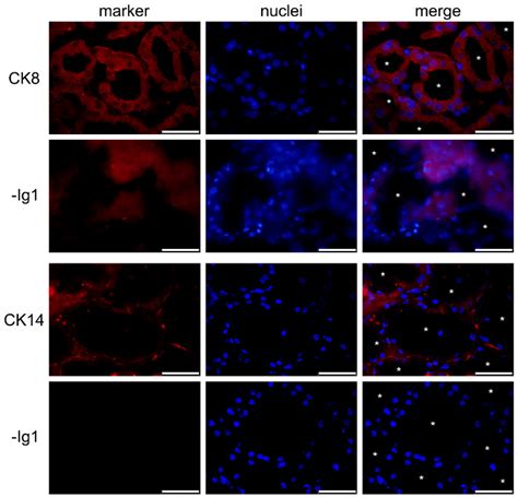 Identification Of Luminal Epithelial Cells And Basal Myoepithelial