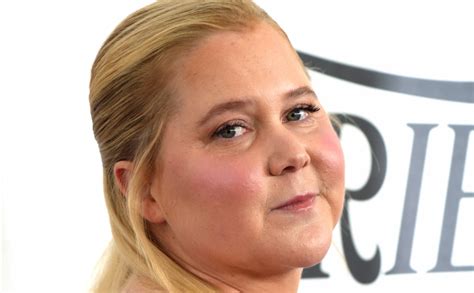 Amy Schumer Shares Health Update Following Recent Diagnosis Parade