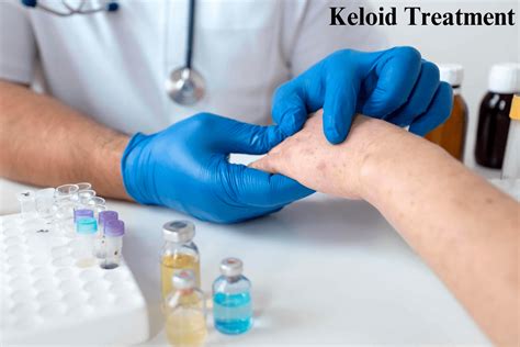 Keloid Treatment and a Reliable Solution