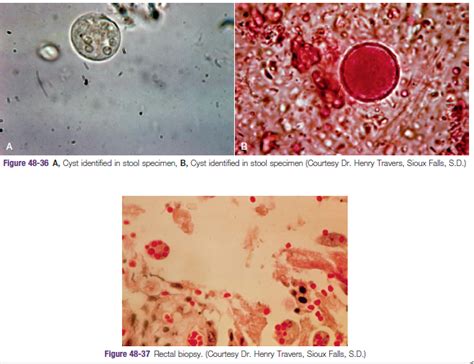 Solved A Figure 48 36 A Cyst Identified In Stool Specimen B Cyst Identified In Stool