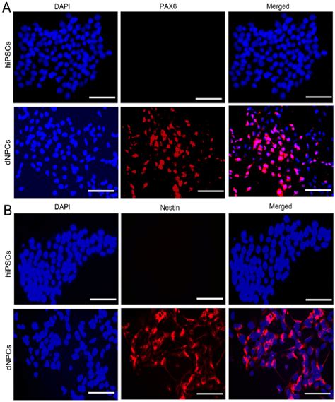 Detection Of Nestin And Pax In Derived Npcs And Hipscs By