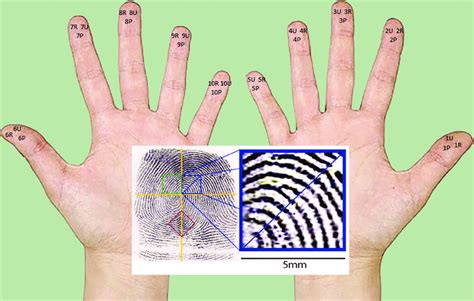 Locations Of Fingerprint Areas Distal Ulnar U Distal Radial R