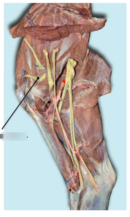 Vm 602 Anatomy Nerves Of The Thoracic Limb Diagram Quizlet