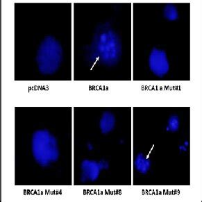 B Brca A Mut Induces Apoptosis Like Brca A In Tnbc Cells Hcc