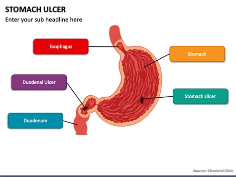 Small Intestine Ulcer Treatment