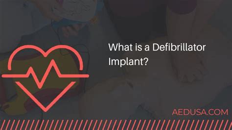 What is a Defibrillator Implant?