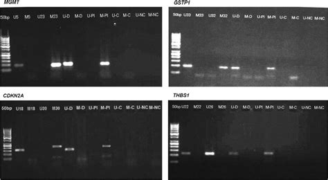 Examples Of Methylation Specific Polymerase Chain Reaction Products Of Download Scientific