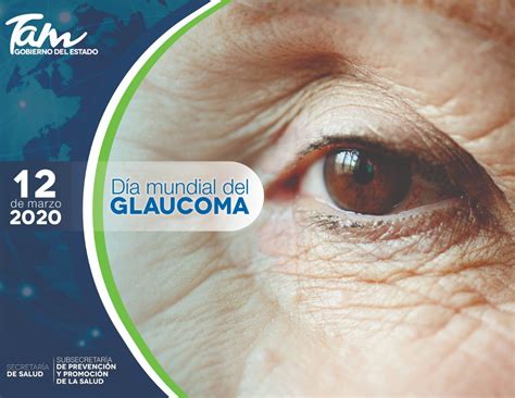 Dr Alejandro García Barrientos On Twitter El Glaucoma Es La Segunda