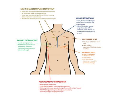 Osce Cardio Praecordium Exam Flashcards Quizlet