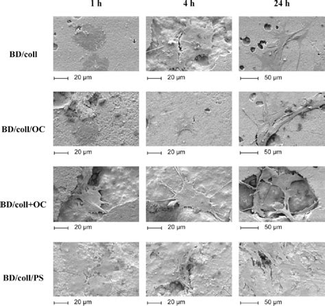 Figure From Influence Of Different Modifications Of A Calcium