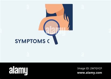 Melanoma Abcdes Symptoms Animation Like Big Diameter Asymmetry Uneven