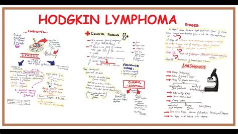 Hodgkin Lymphoma Pathogenesis Clinical Finding Stages And Lab Finding Youtube