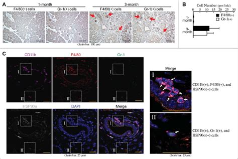 Abundant HSP90a Expressing Myeloid Derived Macrophages In The