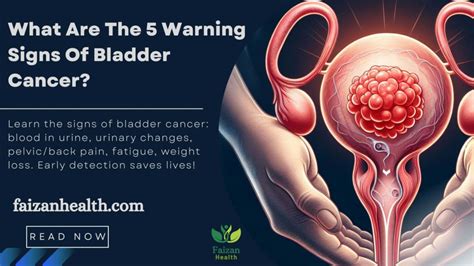 What Are The 5 Warning Signs Of Bladder Cancer Faizan Health