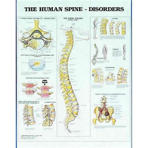 Human Spine Disorders Chart