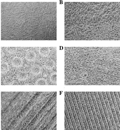 Human Umbilical Vein Endothelial Cells Huvecs Imaged At X160 Download Scientific Diagram