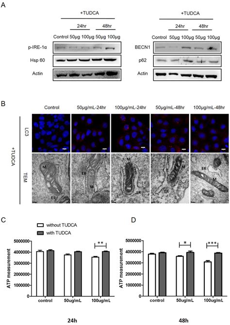 Treatment With The Endoplasmic Reticulum ER Stress Inhibitor TUDCA