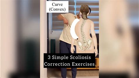 Posture Scoliosis Correction 3 Simple Exercises Thoracic Curve