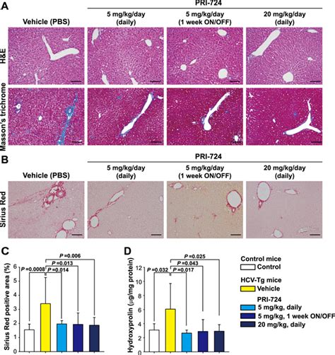 Selective inhibitor of Wnt β catenin CBP signaling ameliorates