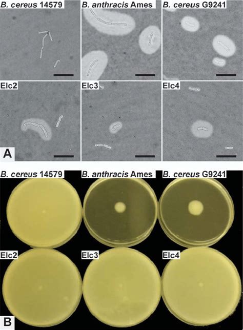 Bacillus Cereus Morphology And Arrangement