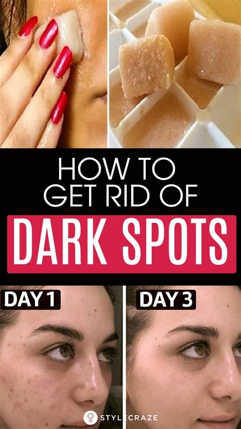 How To Remove Dark Spots On The Face Naturally Howotremvo