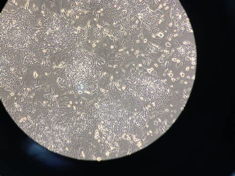 352 Questions With Answers In Fibroblast Culture Science Topic