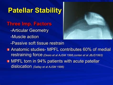 Mpfl Tech Mpfl Reconstruction For Patellar Instability Ppt