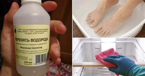 Как применять перекись водорода в быту - Со Вкусом