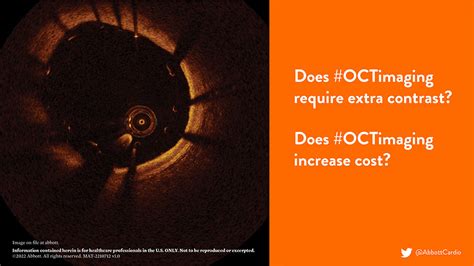 Intravascular Imaging Optical Coherence Tomography Oct Education Abbott