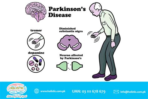 What Is Parkinsons Disease Pd Call At