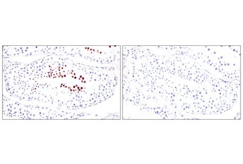 FOXG1 E2W8P Rabbit MAb Cell Signaling Technology